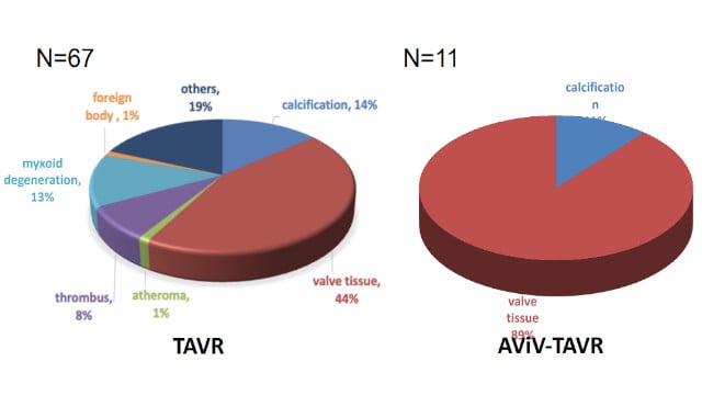 Repeat TAVI