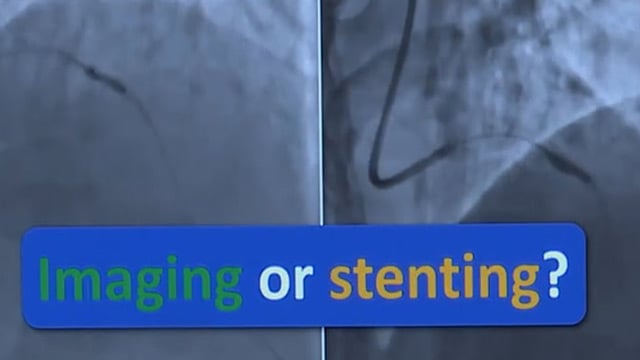 Algorithm approach for severe calcified lesion, what is new?