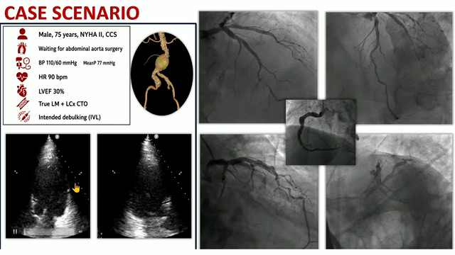 Active unloading with Impella heart pumps in elective and emergent patients