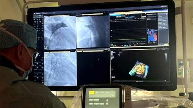 How to become a CHAMPION in LAA closure