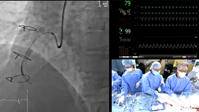 Best clinical CTO cases