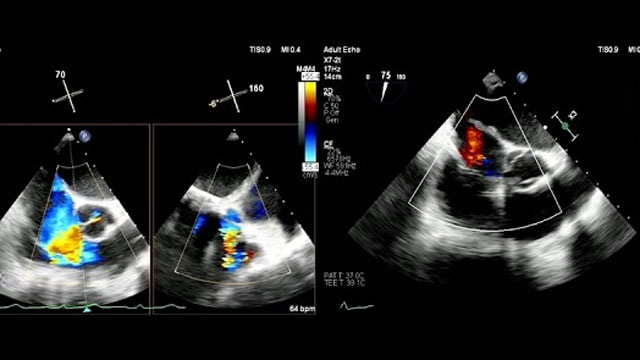 Beyond the horizon - Future of structural heart innovations and PCI