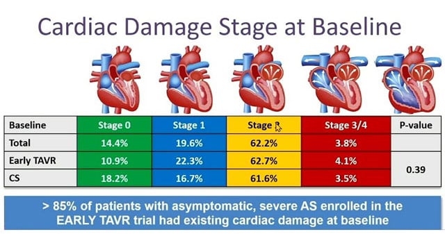 How can we improve the management of aortic stenosis in 2026?