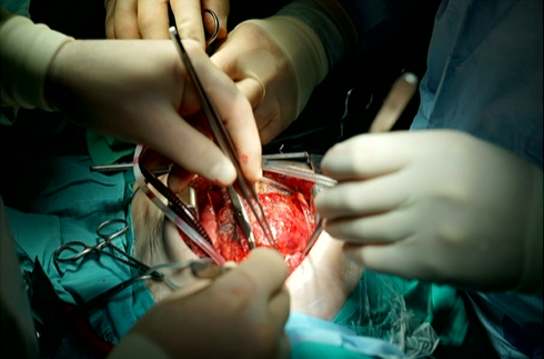 Identifying and planning protected temporary mechanical circulatory support-based procedures in high-risk patients