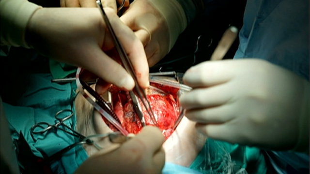 Identifying and planning protected temporary mechanical circulatory support-based procedures in high-risk patients