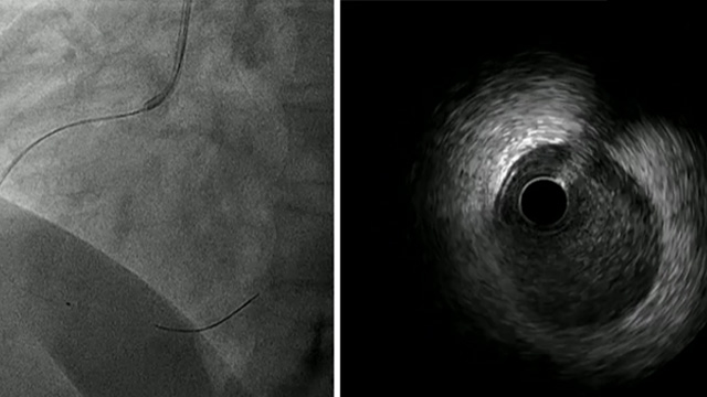 Imaging guidance in everyday practice