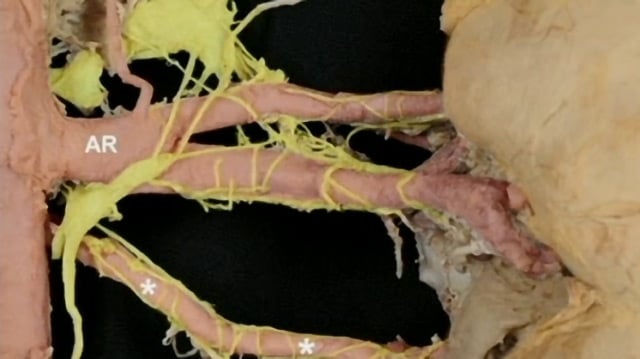 Renal denervation in China: momentum, insights, and evolution