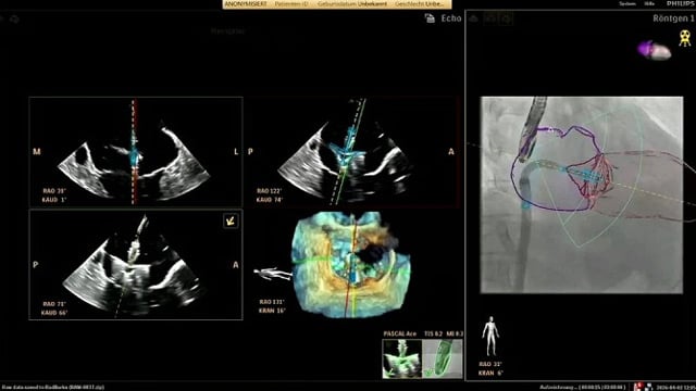Seeing differently, treating better: advanced imaging shaping modern structural heart practice