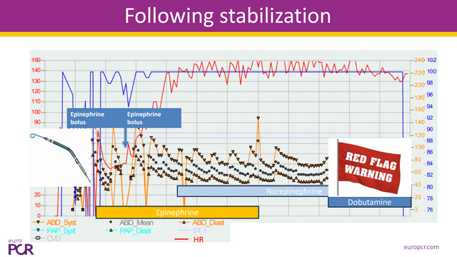 The pearl of unloading with mechanical circulatory support