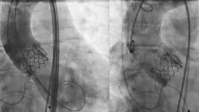 Built to last: lifetime management for durability and beyond