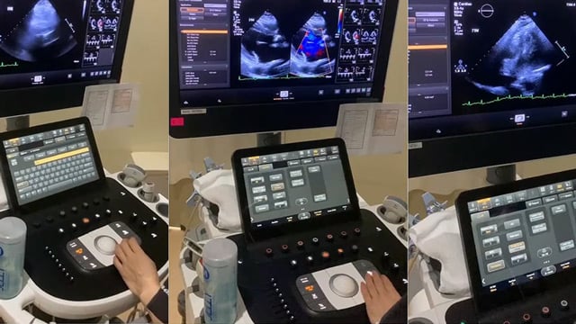 Healthcare professionals in the structural heart disease treatment