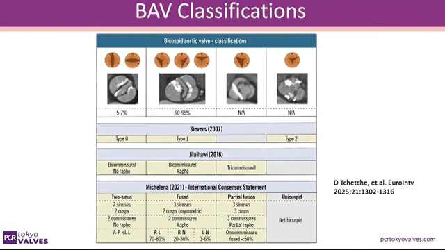 Mastering techniques from basic to complex - Advanced TAVI