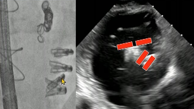 Miscellaneous complications: my worst nightmare