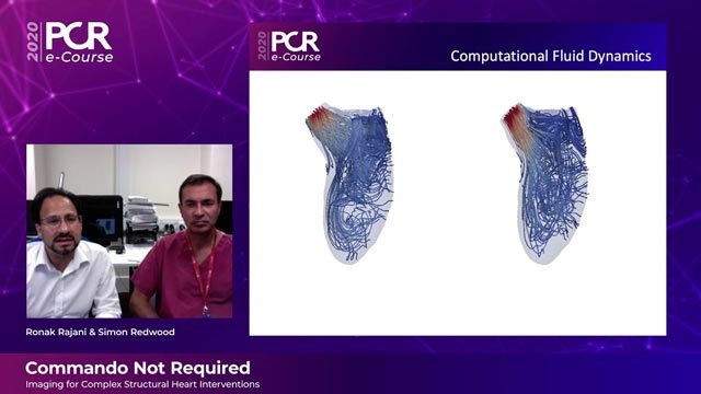 Commando not required 'imaging for complex structural heart interventions with Valve ASSIST2'