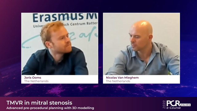 TMVR in mitral stenosis - Advanced pre-procedural planning with 3D modelling