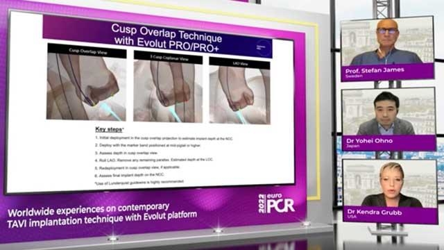 Worldwide experiences on contemporary TAVI implantation technique with Evolut platform