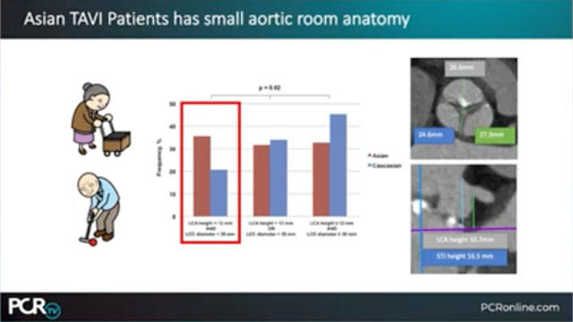 Outlook on TAVI in Asian patients: how can the Navitor valve with the FlexNav delivery system enable successful procedural outcomes?