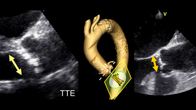 Imaging: conclusion