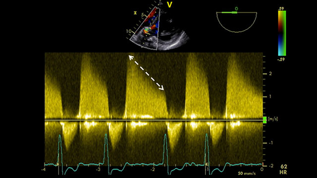 Post-implantation assessment