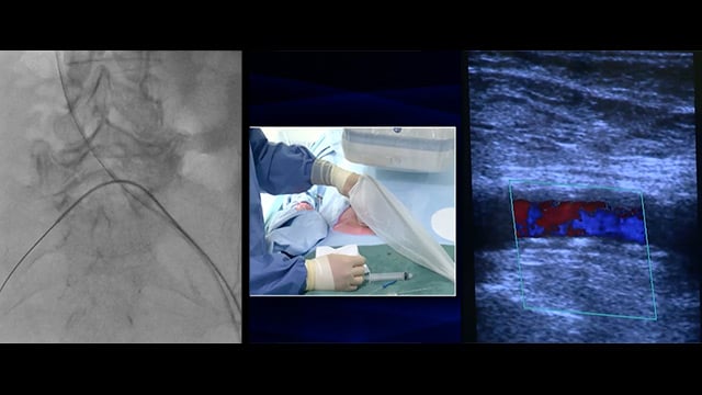 Procedural concepts: vascular access