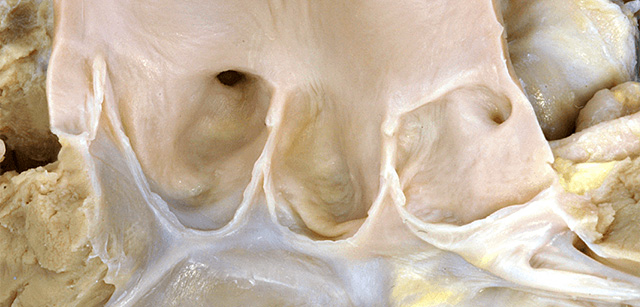  Coronary arteries