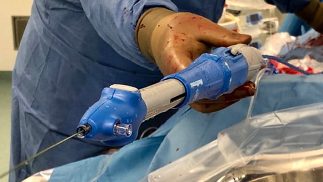 Commissural alignment during TAVI