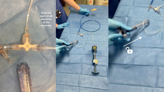 Simplified dual-indeflator approach for bioprosthetic valve fracture