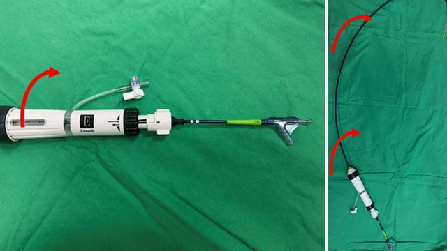 A simple maneuver to track the wire during a transseptal mitral valve-in-valve procedure