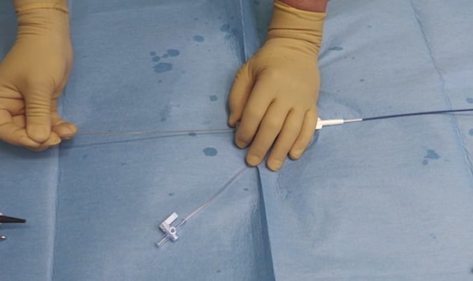 Remove the shaft technique: tips and tricks