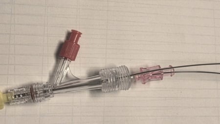 Self-made steerable catheter to cross the aortic valve in severe aortic stenosis