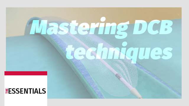 Effective techniques for performing DCB angioplasty