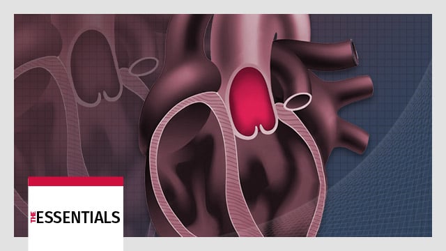 TAVI Essentials: From patient selection to procedural success