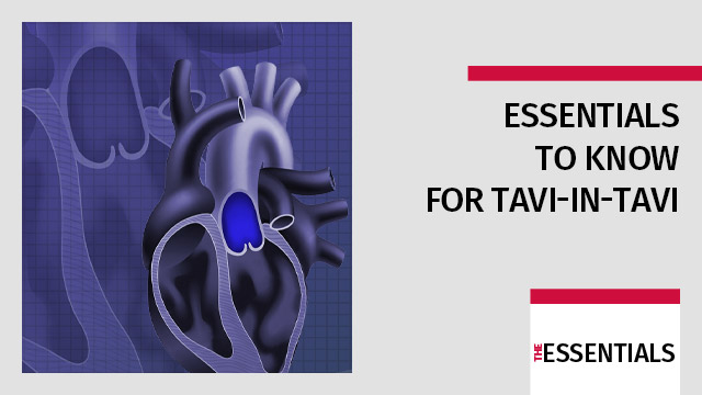 Essentials to know for TAVI-in-TAVI