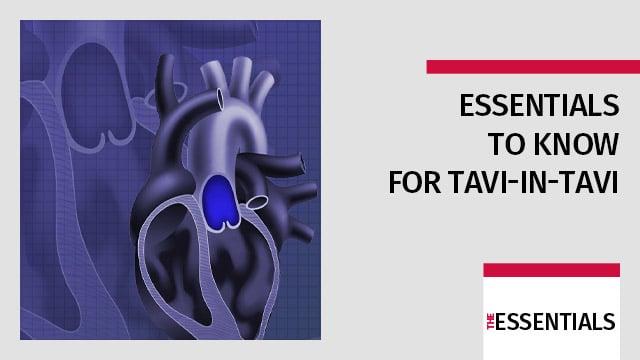 Essentials to know for TAVI-in-TAVI