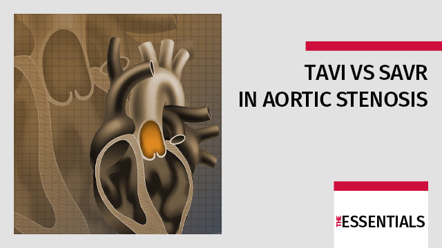 TAVI versus SAVR in aortic stenosis, is the debate still relevant in 2026?