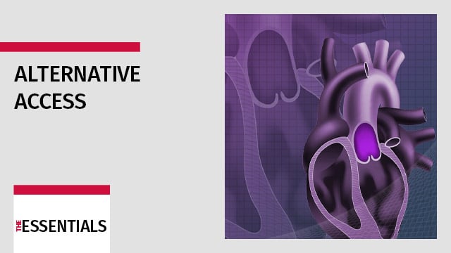 Alternative access, if transfemoral is not working 
