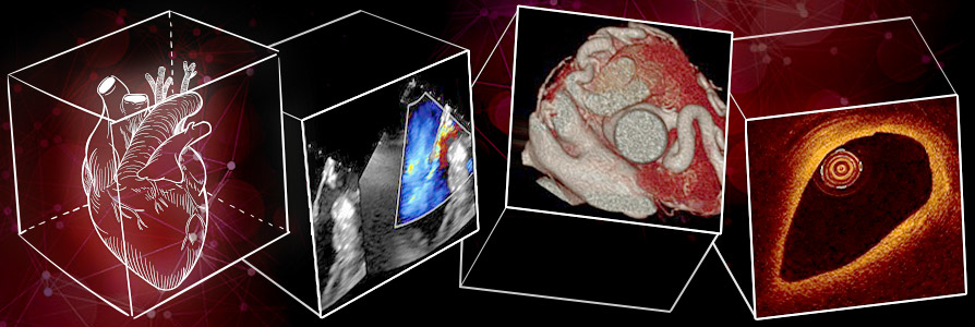 The unimaginable evolution of interventional cardiology from imagination to imaging