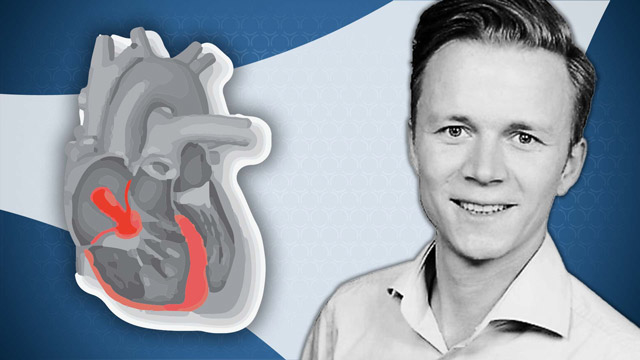 Hemodynamic diagnosis of tricuspid regurgitation/right heart failure
