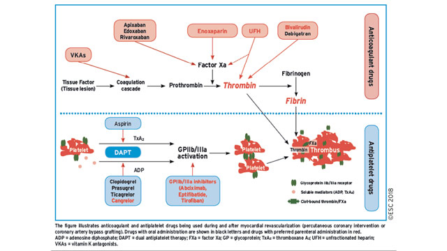 2018 ESC/EACTS Guidelines on myocardial revascularization