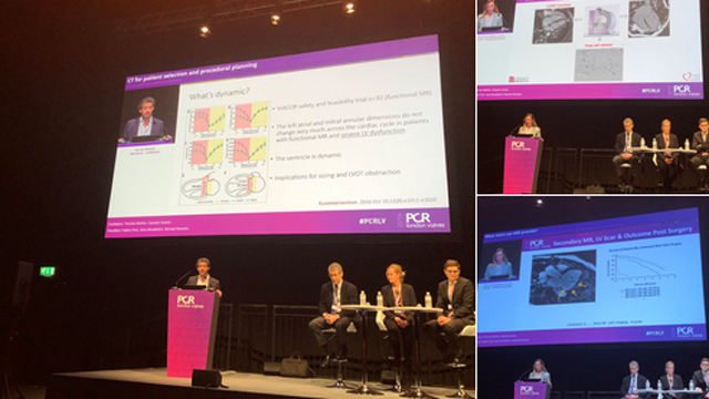 Best of PCR London Valves 2019 #PCRLV #CardioTwitter
