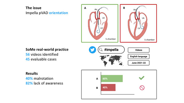 Impella pVAD Malrotation in social media