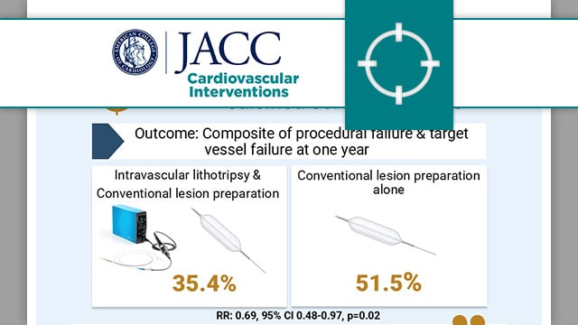 Balloon lithotripsy added to conventional preparation before stent implantation in severely calcified coronary lesions
