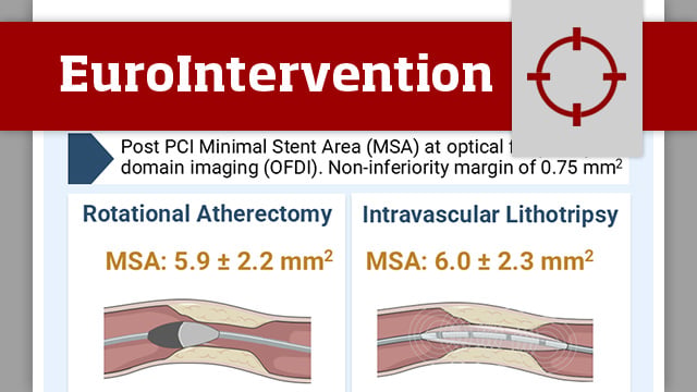 ICARE OFDI: IVL vs rotational atherectomy for calcified lesions
