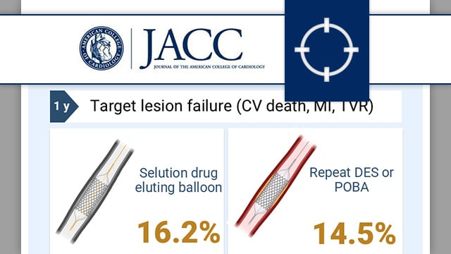 Sirolimus-eluting balloon vs. repeat drug-eluting stent or balloon angioplasty for coronary in-stent restenosis