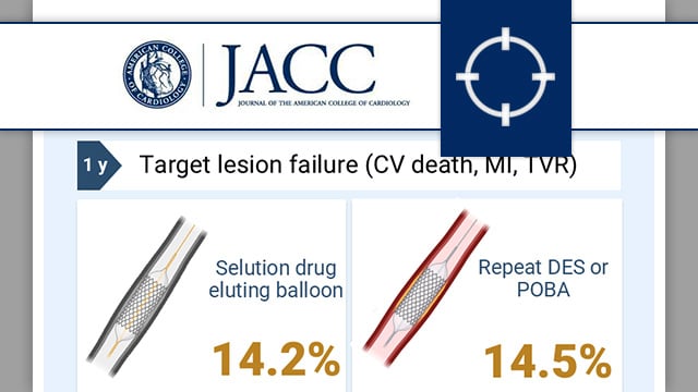 Sirolimus-eluting balloon vs. repeat drug-eluting stent or balloon angioplasty for coronary in-stent restenosis