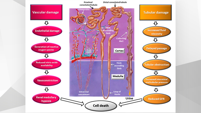 The PCR Textbook - Contrast-induced acute kidney injury in patients undergoing PCI