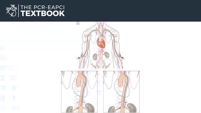 The PCR Textbook chapter on interventions in the reno-visceral circulation