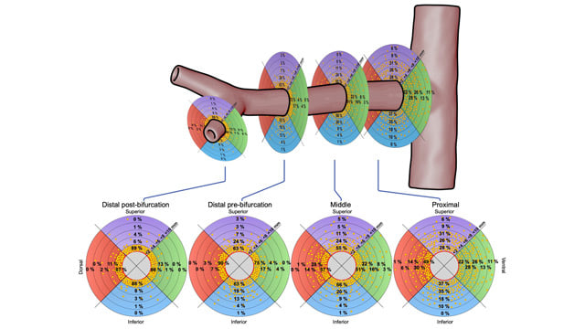 The PCR Textbook on concept, techniques, and clinical effectiveness of renal denervation in hypertension