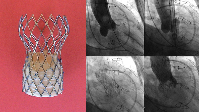 The PCR Textbook on TAVI