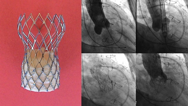 The PCR Textbook on TAVI